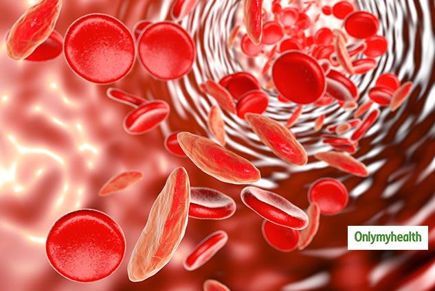 thallesemia disease