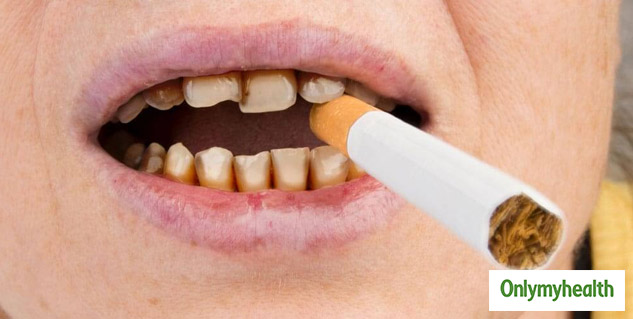 Signs of oral problems due to tobacco