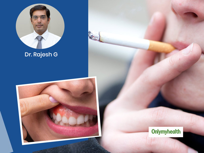 How Tobacco and Smoking Affect Oral Hygiene? Expert Answers