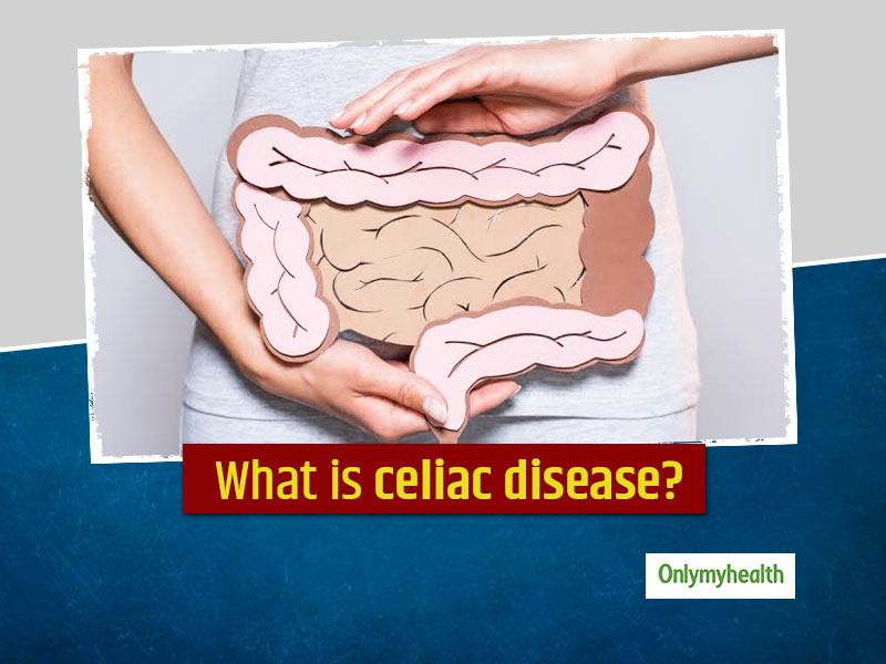Celiac Disease Symptoms, Causes, Diagnosis, Risk Factors, Diet And