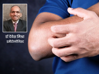 रूमेटाइड अर्थराइटिस के कारण भी हो सकती है स्किन पर रैशेज की समस्या, जानें इसका कारण और इलाज