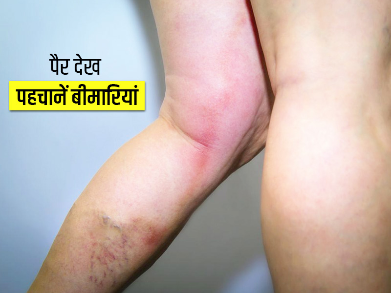 इन 5 बीमारियों के बारे में पहले ही बता सकता है आपका पैर, जानें किन लक्षणों को नहीं करना चाहिए नजरअंदाज