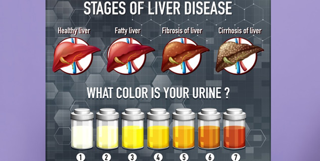 liver diseases 