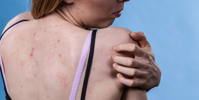 Inside2_hormonalchange