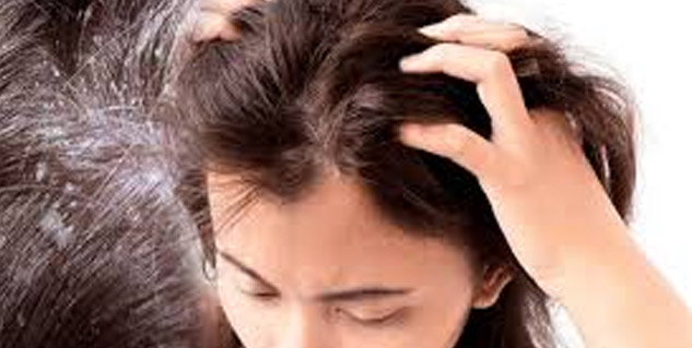 Dryness_in_hairs