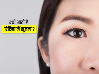 Macular Edema: रेटिना में सूजन के हो सकते हैं 9 कारण, जानें लक्षण और इलाज