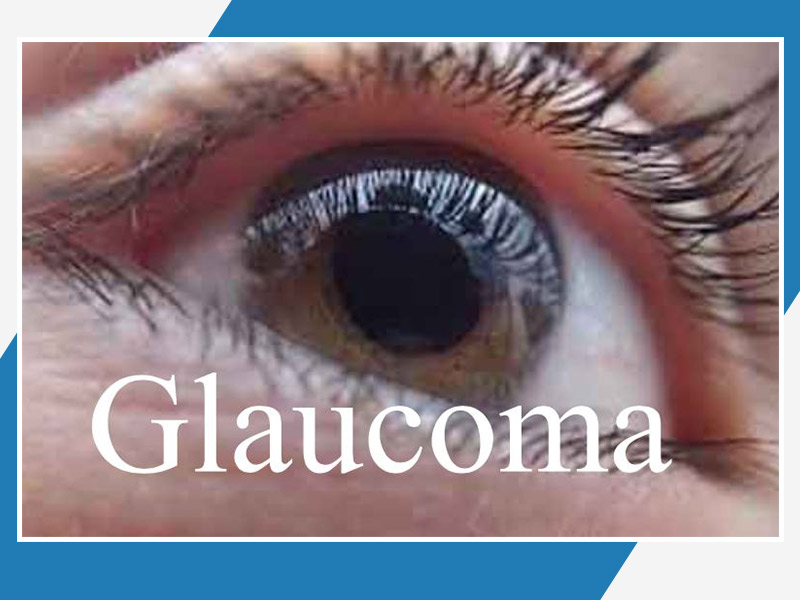 Glaucoma: Who Is At Risk Of Glaucoma, Treatment And The Food Preferred