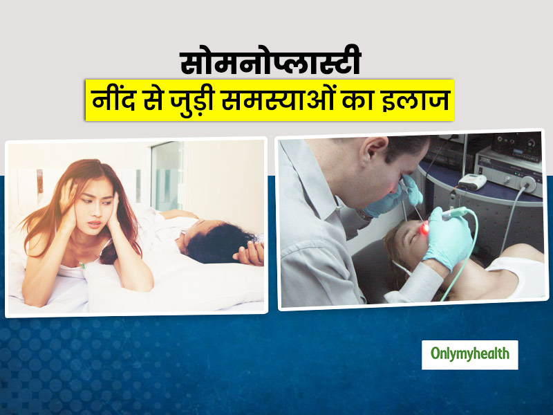 सोते वक्त खर्राटों की समस्या में बेहद कारगर मानी जाती है सोमनोप्लास्टी सर्जरी, जानें इसके बारे में