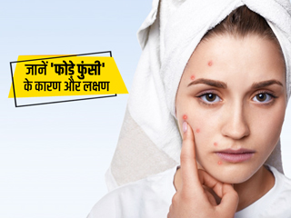 Abscess: फोड़े फुंसी से हैं परेशान तो जान लें इसके कारण, लक्षण और उपचार