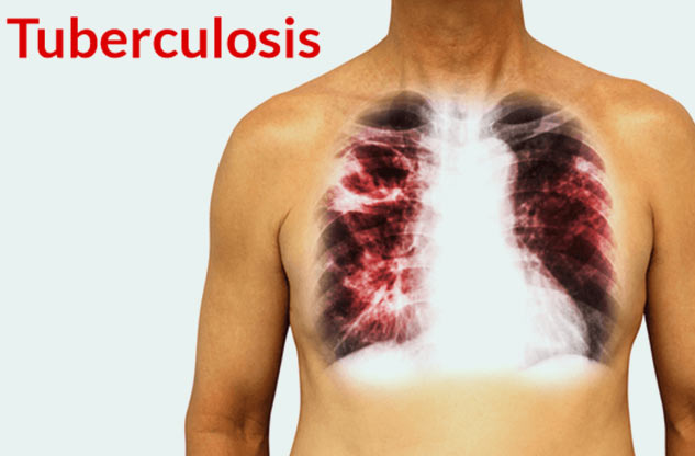 Ozone Therapy Benefits