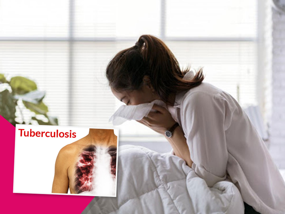 Tuberculosis Patient