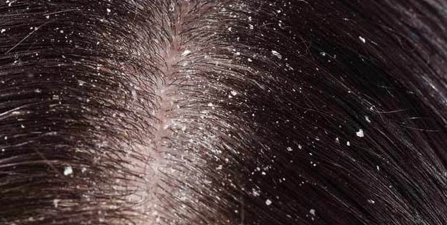 Inside1_lemonforhair