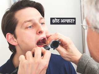 क्यों होते हैं गले में छाले? जानें थ्रोट अल्सर (Throat Ulcer) का कारण, लक्षण और इलाज के लिए घरेलू उपाय
