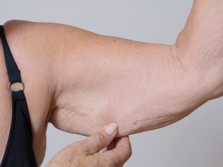 उम्र बढ़ने पर क्यों कम होने लगता है त्वचा का लचीलापन (Skin Elasticity)? जानें इसके कारण