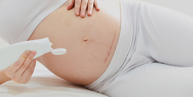 different-pregnancy-delivery-baby-onlymyhealth