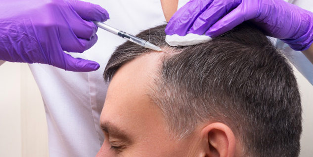 hair injection