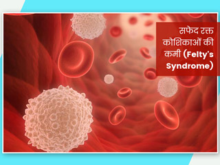Felty's Syndrome: सफेद रक्त कोशिकाओं की कमी होने पर दिखाई देते हैं ये 11 लक्षण, जानें कारण और उपचार