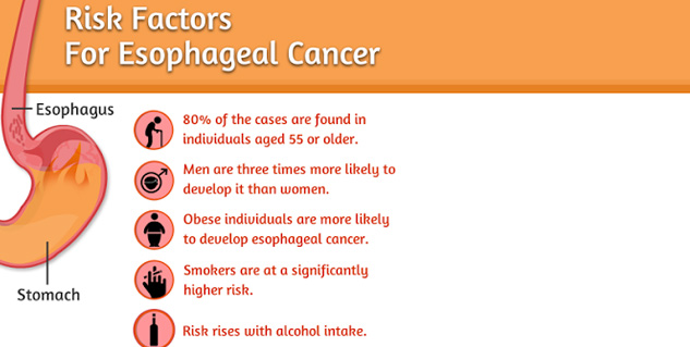 Symptoms_of_esophageal_cancer
