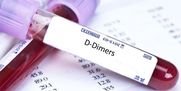 d-dimer