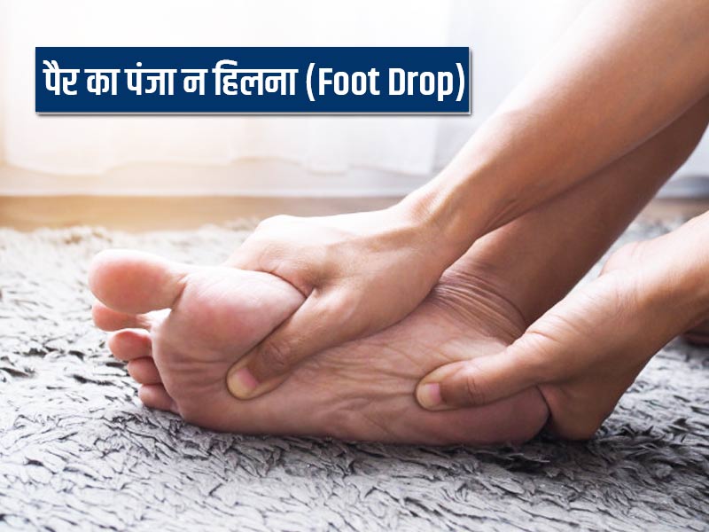 Foot Drop: अगर पैर का पंजा हो जाए सुन्न तो हो सकते हैं ये 6 कारण, जानें लक्षण और उपचार