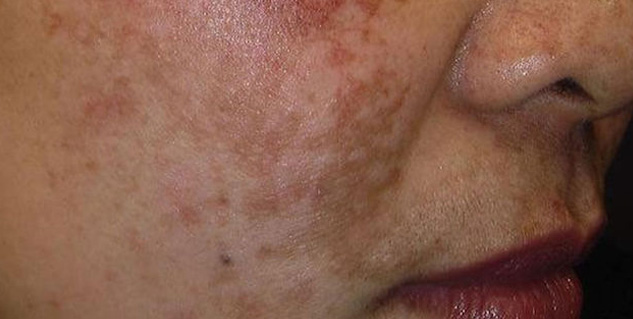 skin