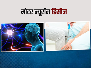 न्यूरो (तंत्रिकाओं) से जुड़ी गड़बड़ी के कारण हो सकती हैं ये 5 बीमारियां, जानें 'मोटर न्यूरॉन डिसीज' के लक्षण