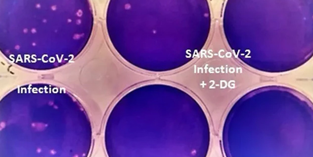 Inside2_DRDOdevelopedcovidmedicine