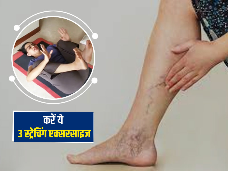 पीठ दर्द और वेरिकोज वेन्स की समस्या में करें ये 3 स्ट्रेचिंग एक्सरसाइज, Rujuta Diwekar से जानें करने का तरीका