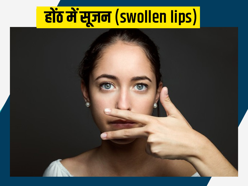 Swollen Lips Causes: 'होंठों में सूजन' आने के पीछे होते हैं ये 4 कारण, जानें लक्षण और उपचार भी