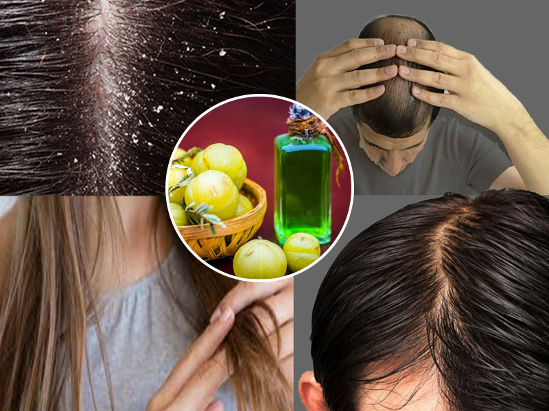 Amla oil deals for hair growth