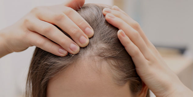hairfall