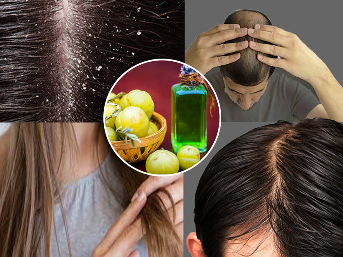 Amla Oil For Hair Growth – Mauli Rituals