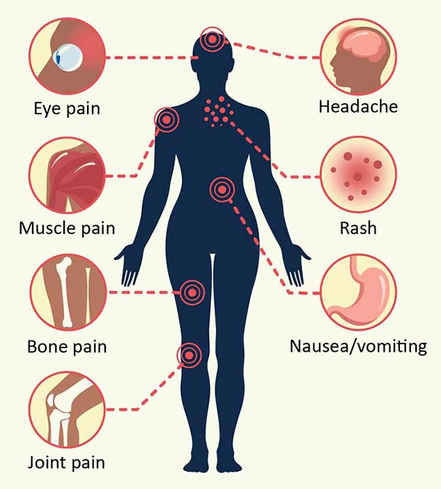 National Dengue Day 2021: Different Kinds of Dengue Infections and ...