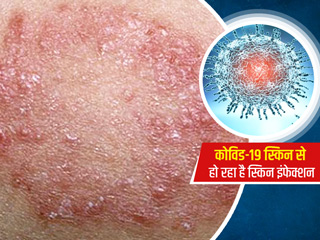 Covid-19 Symptoms : अब स्किन पर फैल रहा है कोरोना, ये लक्षण दिखने पर तुरंत करवाएं अपना कोविड-19 टेस्ट