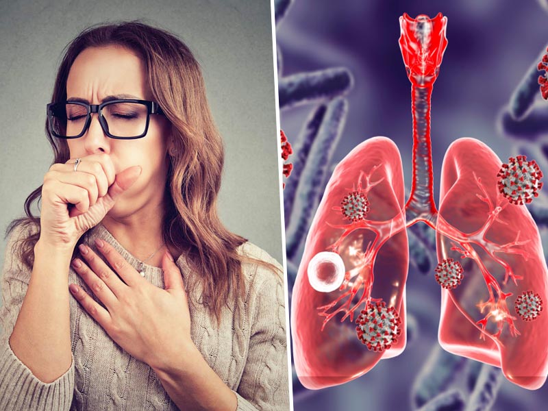 How Can COVID-19 Make The Interstitial Lung Infection Worse? | OnlyMyHealth