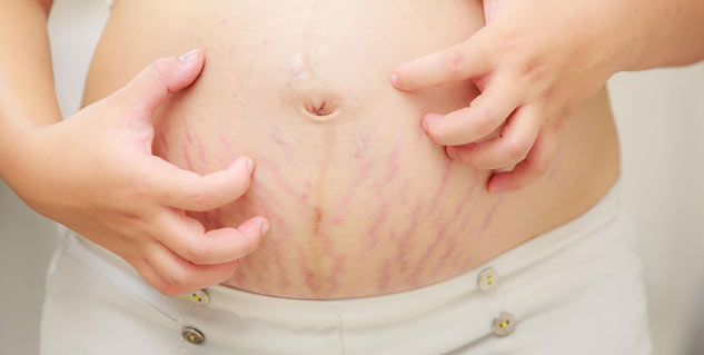 itchiness_during_pregnancy