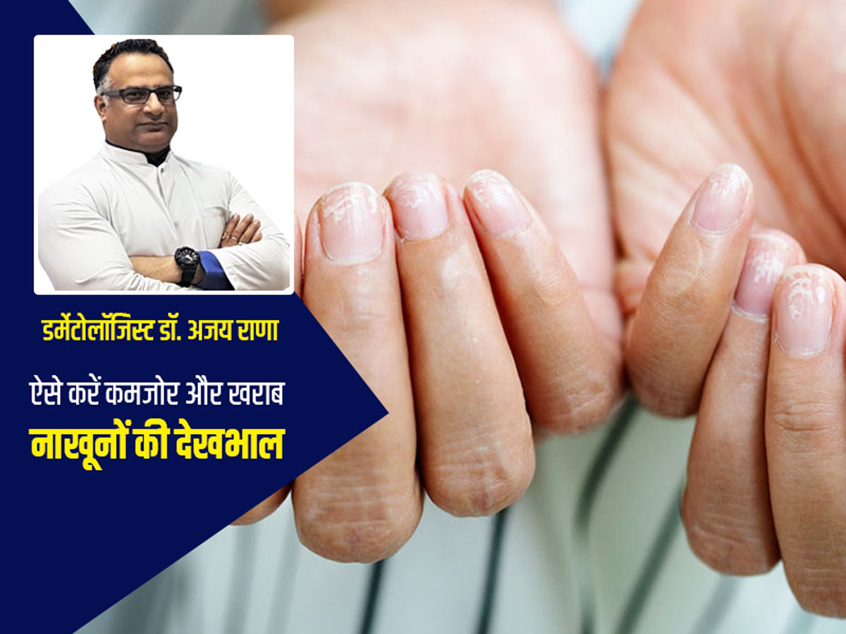 7 Tips To Take Care Of Your Brittle And Weak Nails in Hindi | कमजोर और खराब नाखूनों की कैसे करें देखभाल | Onlymyhealth 7 Tips To Take Care Of Your Brittle And Weak Nails in Hindi | कमजोर और खराब नाखूनों की कैसे करें देखभाल | Onlymyhealth