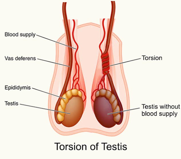 Know The Causes, Symptoms, Home Remedies And When To See A Doctor