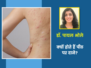 पीठ पर दाने निकलने का कारण और इलाज
