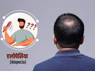 हॉलीवुड अभिनेता विल स्मिथ की पत्नी हैं एलोपेसिया का शिकार, जानें क्या है बालों से जुड़ी ये बीमारी