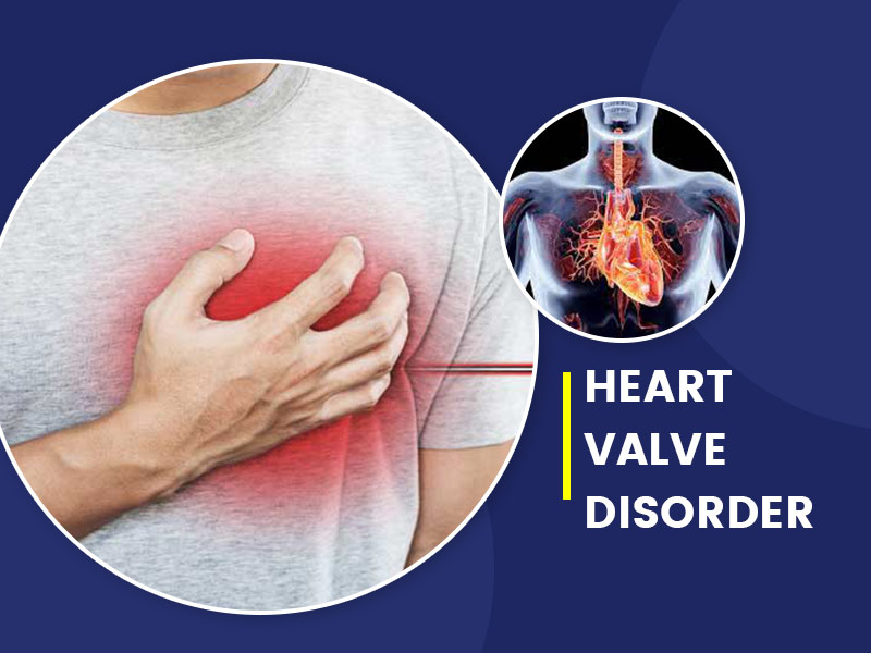 Heart Valve Disease Symptoms In Malayalam