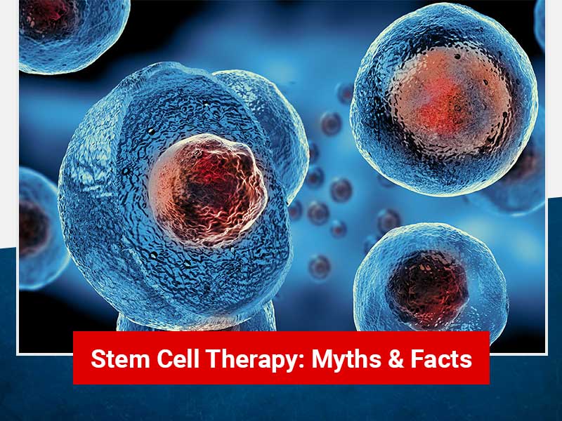 Know Myths and Facts Related to Stem Cell Therapy