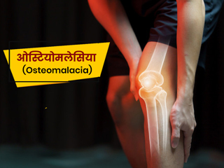 Osteomalacia: जानें ओस्टियोमलेसिया (नरम हड्डी) होने के कारण, लक्षण और बचाव