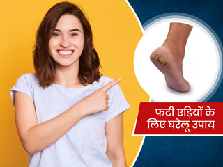 फटी एड़ियों के लिए आसान घरेलू उपाय, घर में मौजूद इन 6 चीजों से दूर करें ये समस्या