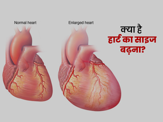 हार्ट का साइज बढ़ने के क्या हैं कारण? जानें इसके लक्षण और बचाव के टिप्स