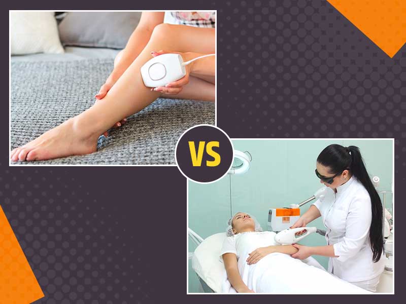 Laser Hair Removal At Home Vs Laser Clinics- Which Is Better?