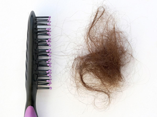 बाल झड़ने का कारण हो सकता है इन 7 फूड्स का ज्यादा सेवन