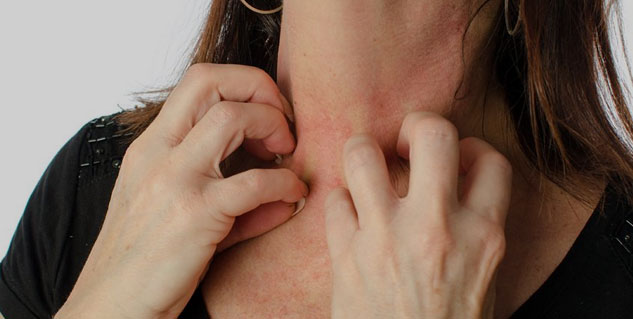 heat-rash-in-hindi