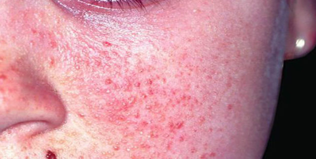 Inside1_skinproblemscovidpatiets