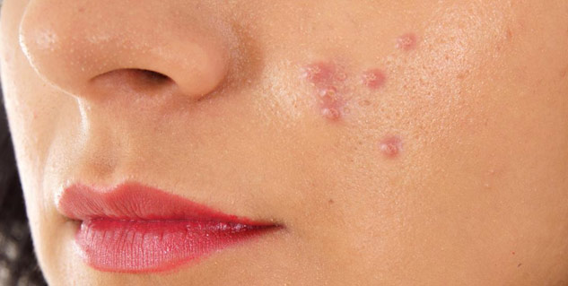 Inside2_skinproblemscovidpatiets